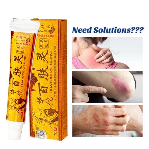 HUATUOBAIFULING Natural Chinese Herbal Medicine Cream Eczema Psoriasis Antibacterial Antifungal